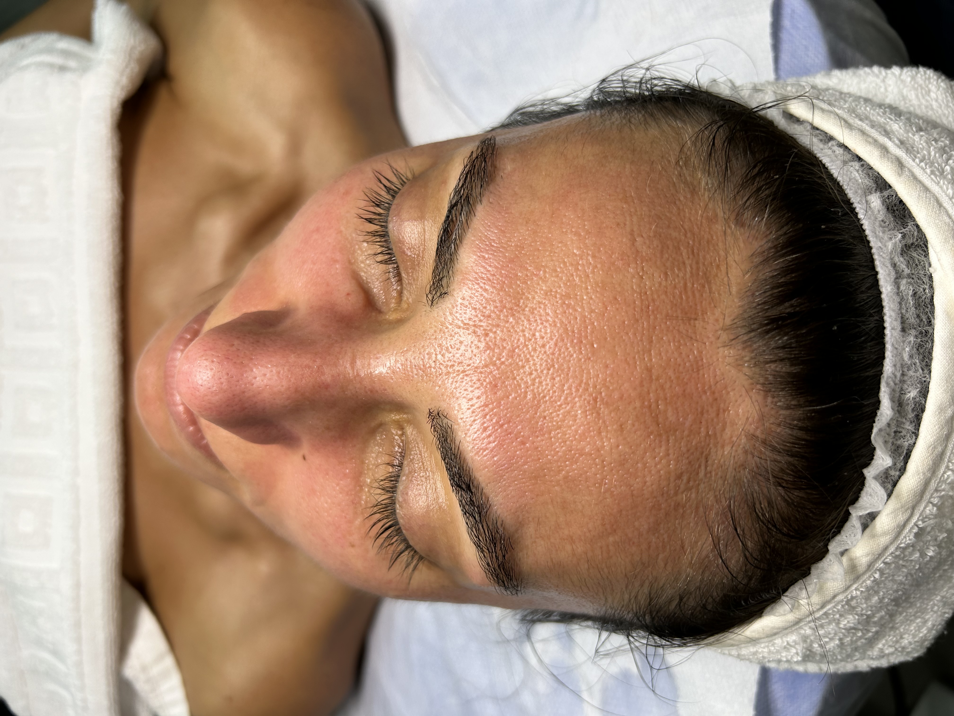 Tratament facial